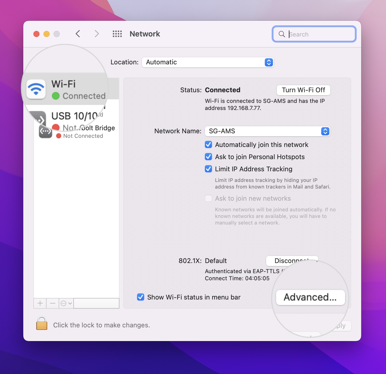 Open Advanced settings of the network on Mac to renew the IP 